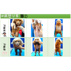 7/18 #病例分享 7/18 #病例分享