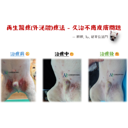 6/20 再生醫療(外泌體)療法 - 久治不癒皮膚問題 6/20 再生醫療(外泌體)療法 - 久治不癒皮膚問題