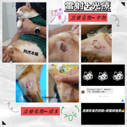 病歷分享-4級雷射+光生物療法 病歷分享-4級雷射+光生物療法